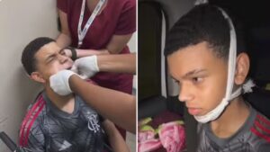 Vídeo: un adolescente bosteza y termina en urgencias luego de que se le “cayera la mandíbula”
