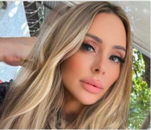 Vídeos: la empresaria brasileña Andreina Vieira Gaspar muere tras 6 cirugías estéticas faciales de más de ocho horas